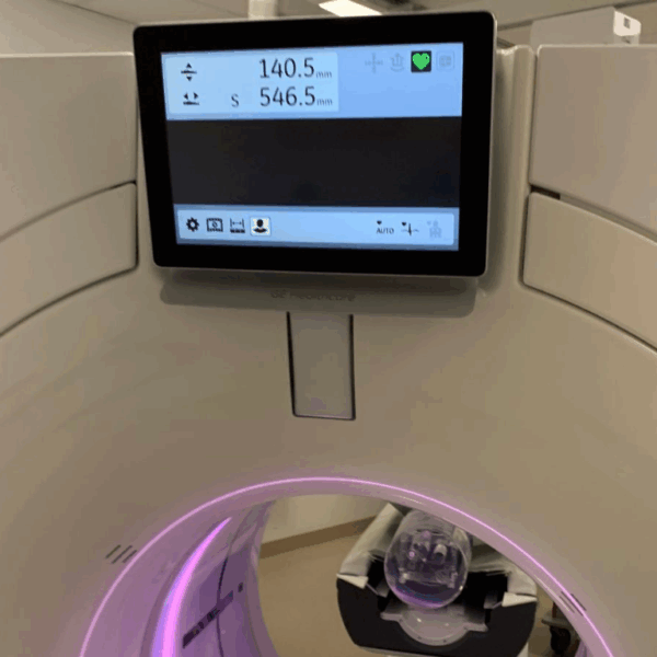 GE Revolution Apex 512 - 2014