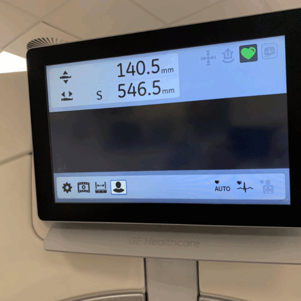 GE Revolution Apex 512 - 2014