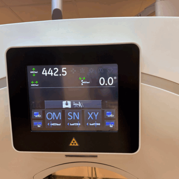 GE Revolution Frontier - 2018