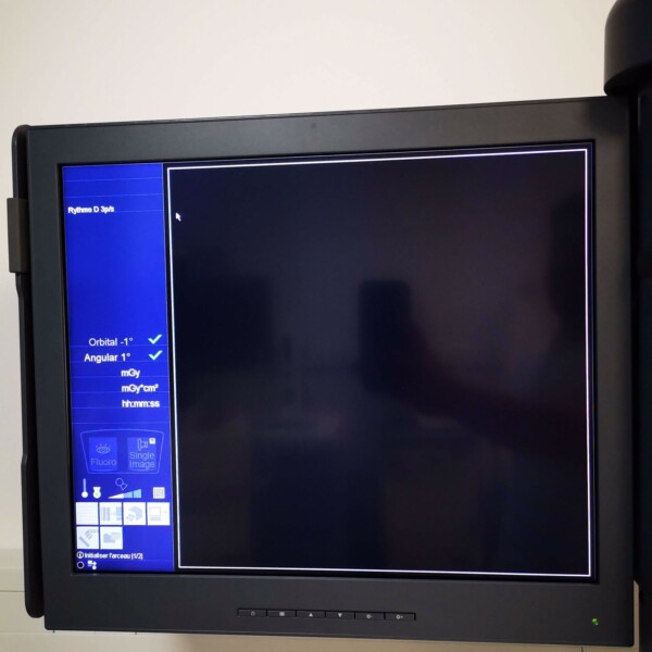 Siemens Cios Alpha - 2020