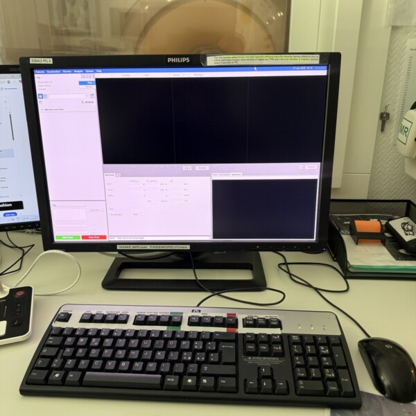 Philips Ingenia 1.5T - 2014