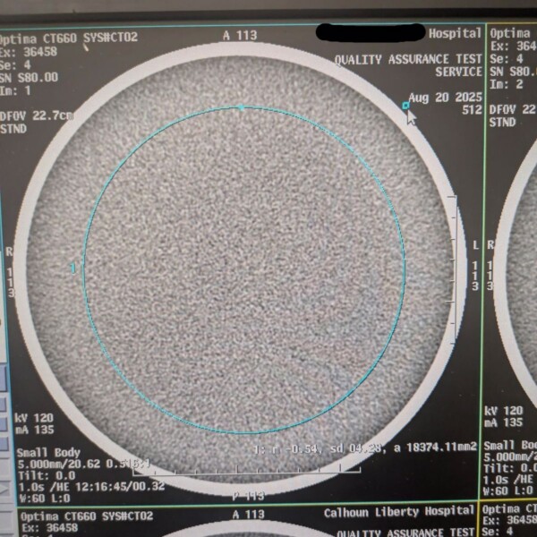 GE Optima CT660 - 2013
