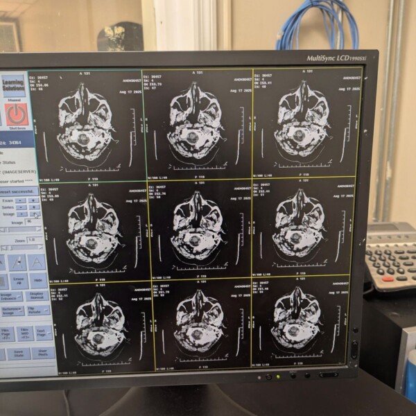 GE Optima CT660 - 2013