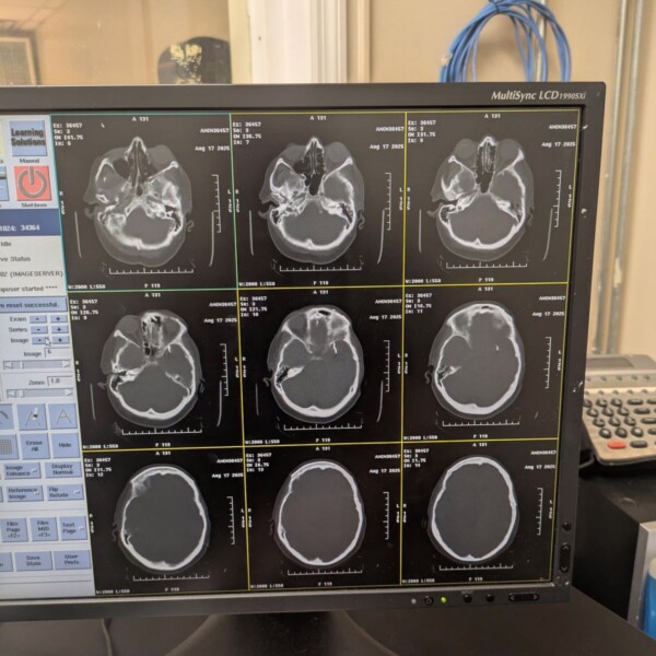 GE Optima CT660 - 2013