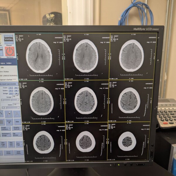 GE Optima CT660 - 2013